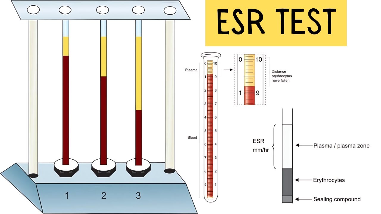 Introduction ESR